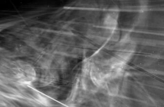 Behold the Closest Photos of the Solar Ever Taken