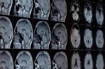 Our Brains Include Lithium—and Its Loss Would possibly Assist Drive Alzheimer’s, Research Finds