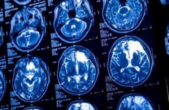 Sam Altman Reportedly Launch Rival Mind-Chip Startup to Compete With Musk’s Neuralink